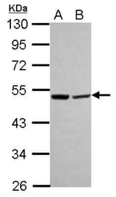 Western Blot: LACTB Antibody [NBP2-15582]