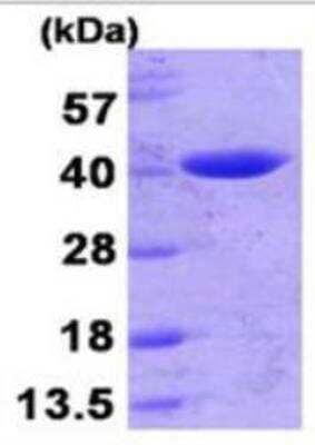 SDS-PAGE: Recombinant E. coli beta-lactamase His Protein [NBP1-72284]