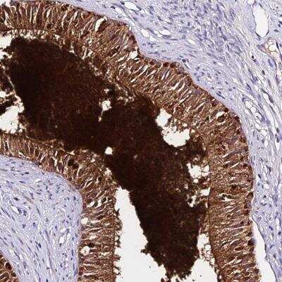 Immunohistochemistry: Beta-defensin 106B Antibody [NBP2-46716]