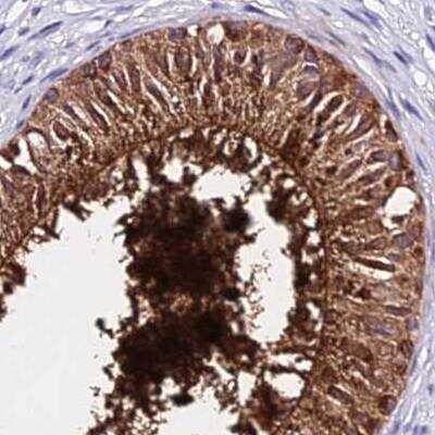 Immunohistochemistry: Beta-defensin 106B Antibody [NBP2-46716]