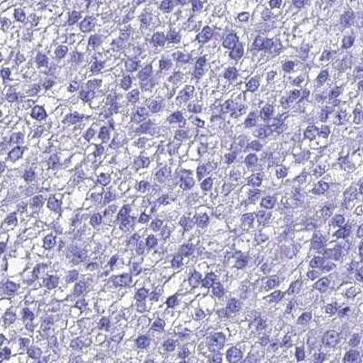 Immunohistochemistry: Beta-defensin 106B Antibody [NBP2-46716]