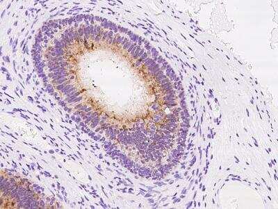 Immunohistochemistry-Paraffin: Beta-defensin 106B Antibody [NBP3-06276]