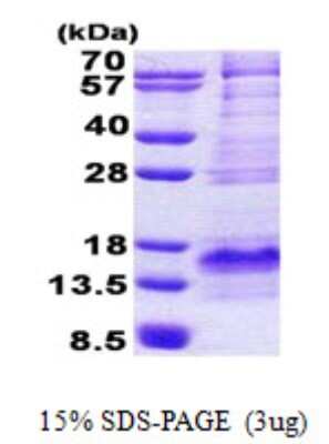 SDS-PAGE: Recombinant Human Bex1 His Protein [NBP2-22718]