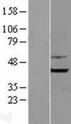 Western Blot: Endophilin B1/Bif-1 Overexpression Lysate [NBL1-15933]