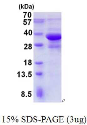 SDS-PAGE: Recombinant Human Endophilin B1/Bif-1 His Protein [NBP2-23467]