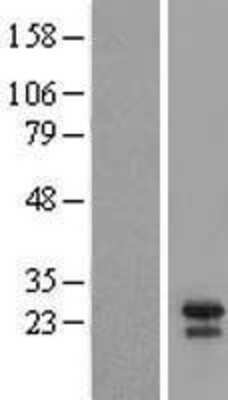 Western Blot: BID Overexpression Lysate [NBL1-07979]