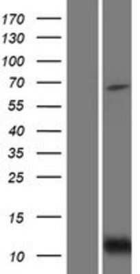 Western Blot: BID Overexpression Lysate [NBP2-10076]