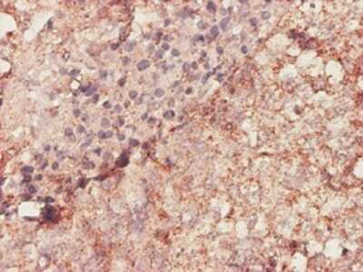 Immunohistochemistry-Paraffin: Biglycan Antibody (4E1-1G7) [H00000633-M01]