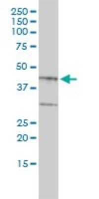 Western Blot: Biglycan Antibody (4E1-1G7) [H00000633-M01]