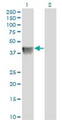 Western Blot: Biglycan Antibody (4E1-1G7) [H00000633-M01]