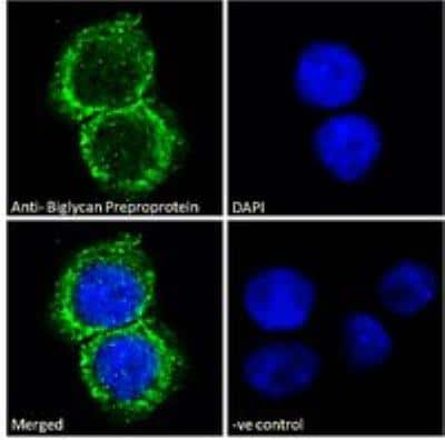 Immunocytochemistry/ Immunofluorescence: Biglycan Antibody [NB100-55407]