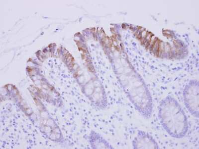 Immunohistochemistry-Paraffin: Biglycan Antibody [NBP1-32371]