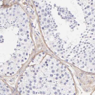 Immunohistochemistry-Paraffin: Biglycan Antibody [NBP1-84971]