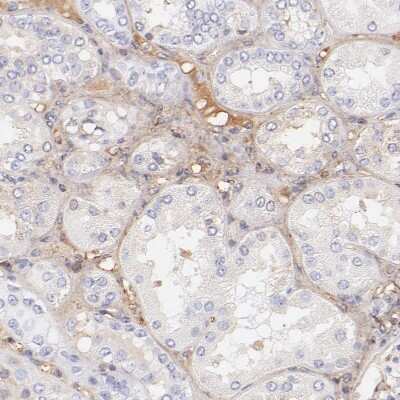 Immunohistochemistry-Paraffin: Biglycan Antibody [NBP1-84971]