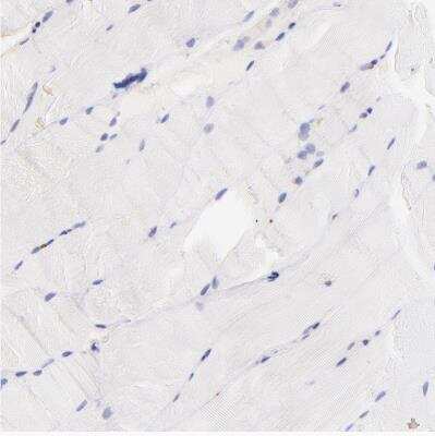 Immunohistochemistry-Paraffin: Biglycan Antibody [NBP1-84971]