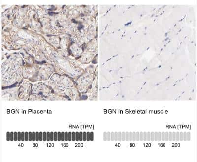 Immunohistochemistry-Paraffin: Biglycan Antibody [NBP1-84971]