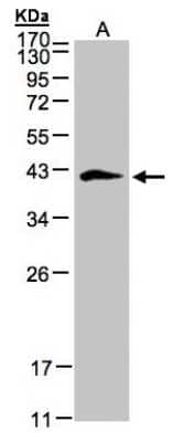 Western Blot: Biglycan Antibody [NBP1-32371]