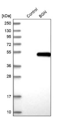 Western Blot: Biglycan Antibody [NBP1-84971]