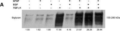 Western Blot: Biglycan Antibody [NBP1-84971]