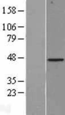 Western Blot: Biglycan Overexpression Lysate [NBL1-07973]