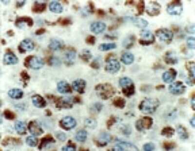 Immunohistochemistry-Paraffin: BIK Antibody [NB100-56109]