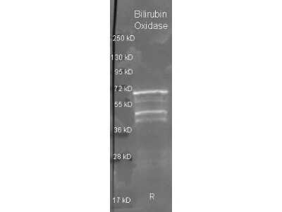 Western Blot: Bilirubin Oxidase Antibody [NBP2-44240]