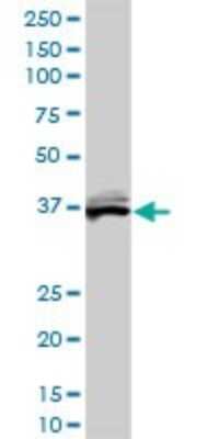 Western Blot: Biliverdin Reductase A/BLVRA Antibody (4G4-2B6) [H00000644-M01]