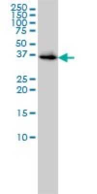 Western Blot: Biliverdin Reductase A/BLVRA Antibody (4G4-2B6) [H00000644-M01]