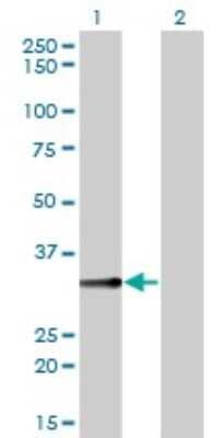 Western Blot: Biliverdin Reductase A/BLVRA Antibody (4G4-2B6) [H00000644-M01]