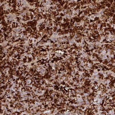 Immunohistochemistry: Biliverdin Reductase A/BLVRA Antibody [NBP2-38725]