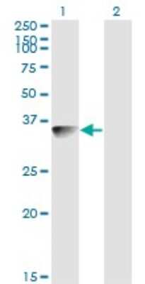 Western Blot: Biliverdin Reductase A/BLVRA Antibody (S2) [H00000644-M03]