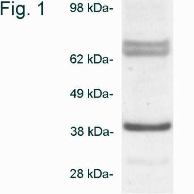 Western Blot: Biliverdin Reductase A/BLVRA Antibody [NB120-3466]