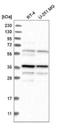 Western Blot: Biliverdin Reductase A/BLVRA Antibody [NBP2-58063]