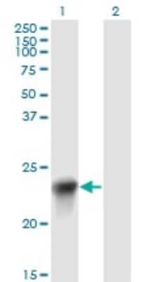 Western Blot: Biliverdin Reductase B/BLVRB Antibody (2F4) [H00000645-M09]