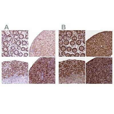 Immunohistochemistry-Paraffin: Biliverdin Reductase B/BLVRB Antibody [NBP1-83434]