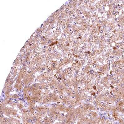 Immunohistochemistry-Paraffin: Biliverdin Reductase B/BLVRB Antibody [NBP1-83434]
