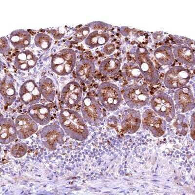 Immunohistochemistry-Paraffin: Biliverdin Reductase B/BLVRB Antibody [NBP1-83434]