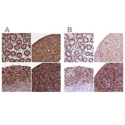 Immunohistochemistry-Paraffin: Biliverdin Reductase B/BLVRB Antibody [NBP1-83435]