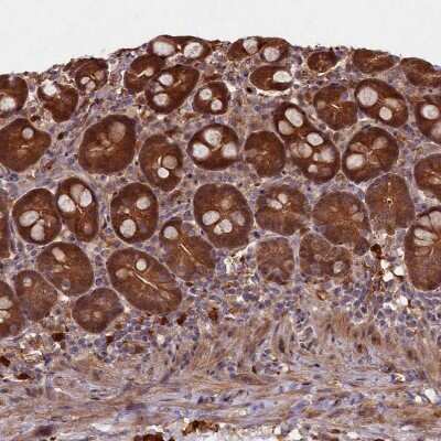Immunohistochemistry-Paraffin: Biliverdin Reductase B/BLVRB Antibody [NBP1-83435]