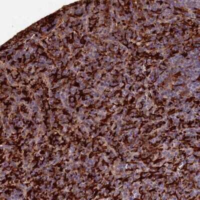 Immunohistochemistry-Paraffin: Biliverdin Reductase B/BLVRB Antibody [NBP1-83435]