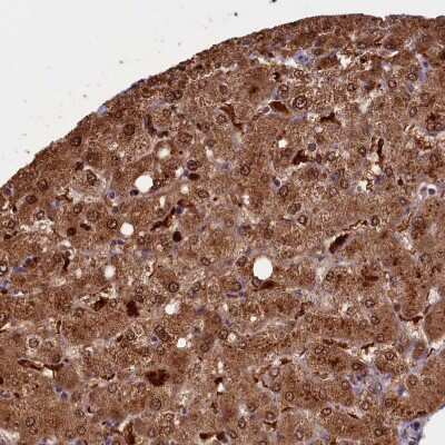 Immunohistochemistry-Paraffin: Biliverdin Reductase B/BLVRB Antibody [NBP1-83435]
