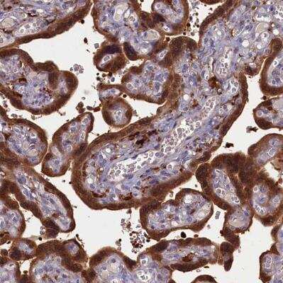 Immunohistochemistry-Paraffin: Biliverdin Reductase B/BLVRB Antibody [NBP1-83435]