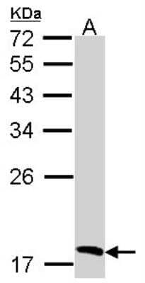 Western Blot: Biliverdin Reductase B/BLVRB Antibody [NBP1-31143]