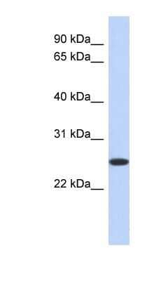 Western Blot: Biliverdin Reductase B/BLVRB Antibody [NBP1-53068]