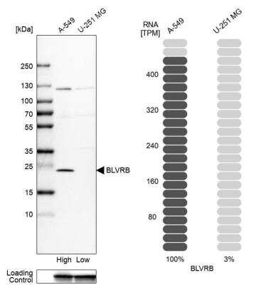 Western Blot: Biliverdin Reductase B/BLVRB Antibody [NBP1-83434]