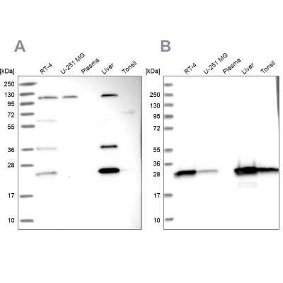 Western Blot: Biliverdin Reductase B/BLVRB Antibody [NBP1-83434]