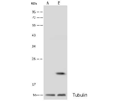 Western Blot: Biliverdin Reductase B/BLVRB Antibody [NBP3-00081]