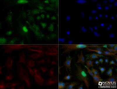 Immunocytochemistry/ Immunofluorescence: Bim Antibody [NBP2-53088]