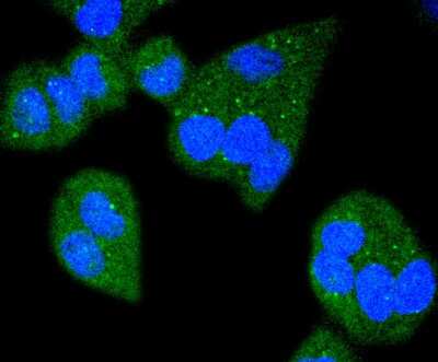 Immunocytochemistry/ Immunofluorescence: Bim Antibody (SU0318) [NBP2-67456]