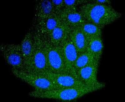 Immunocytochemistry/ Immunofluorescence: Bim Antibody (SU0318) [NBP2-67456]